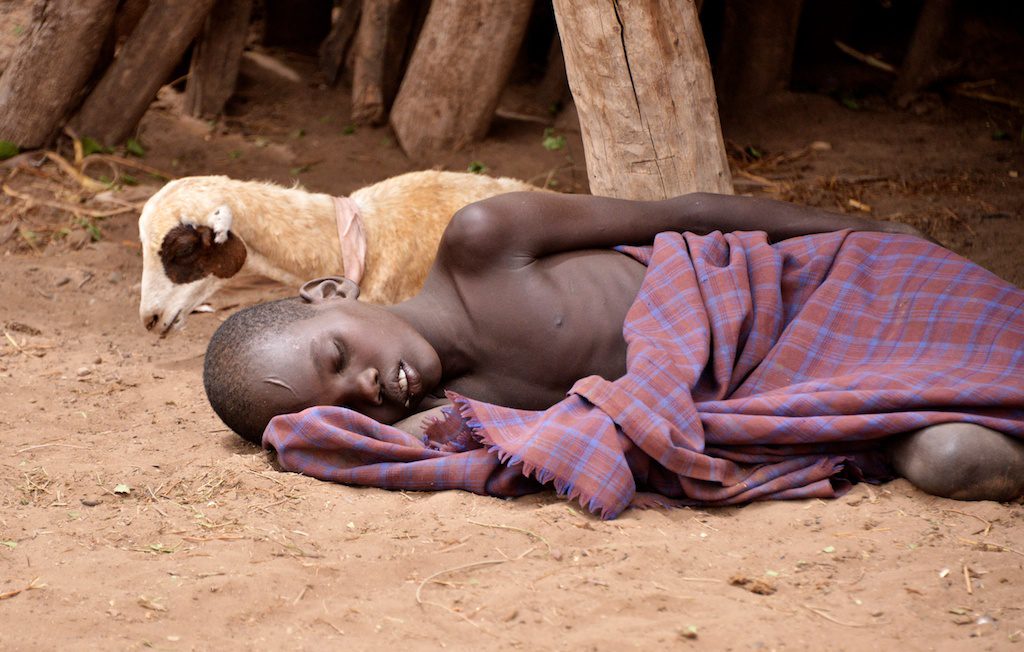 malaria_patient_nyangaton_ethiopia_15151075077_wikipedia