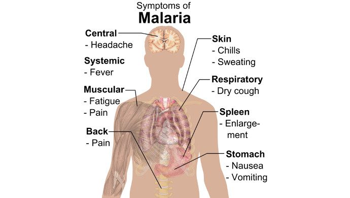 symptoms_of_malaria